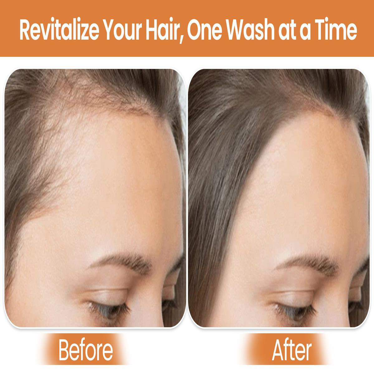 Biotin Shampoo & Conditioner